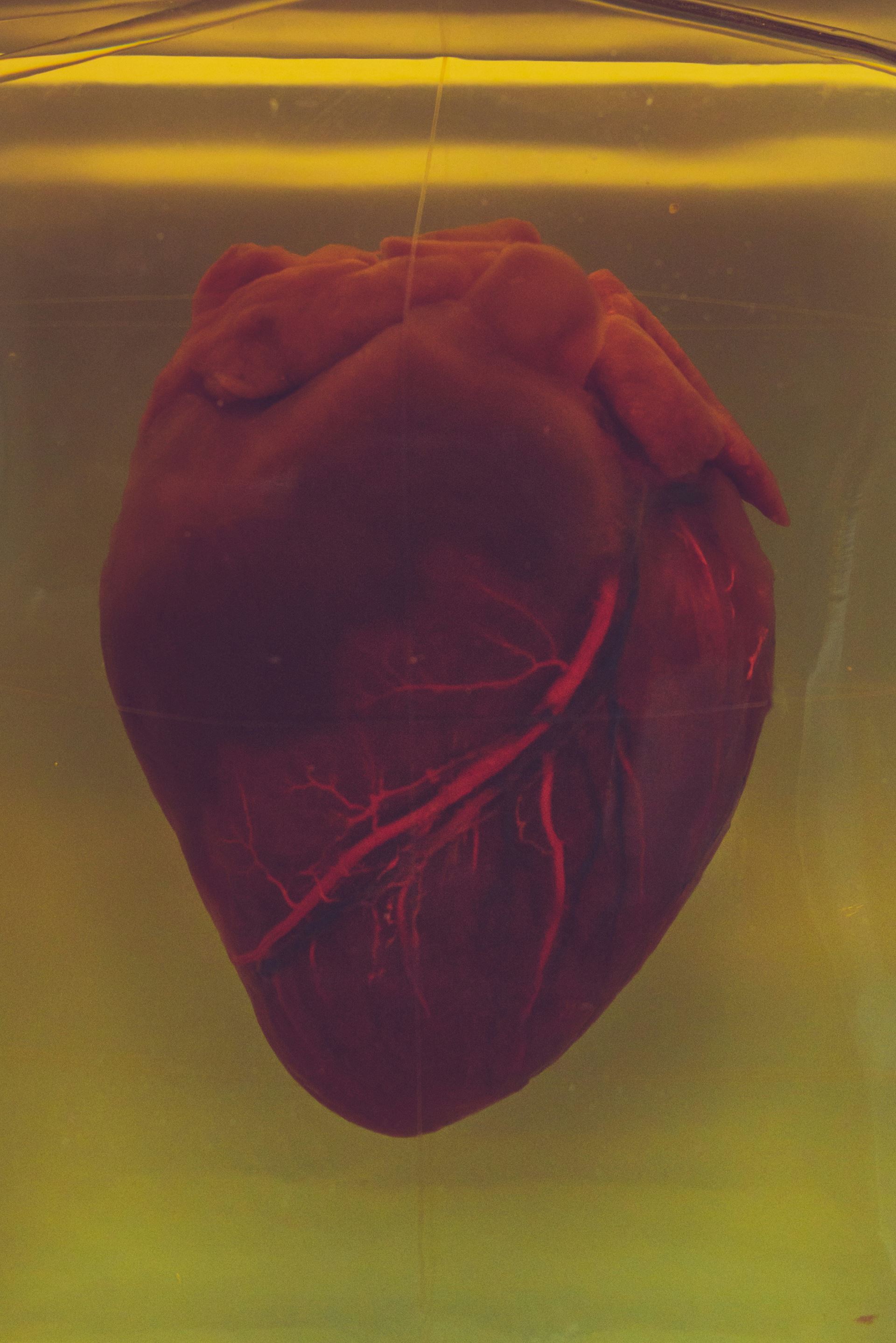 Coronary