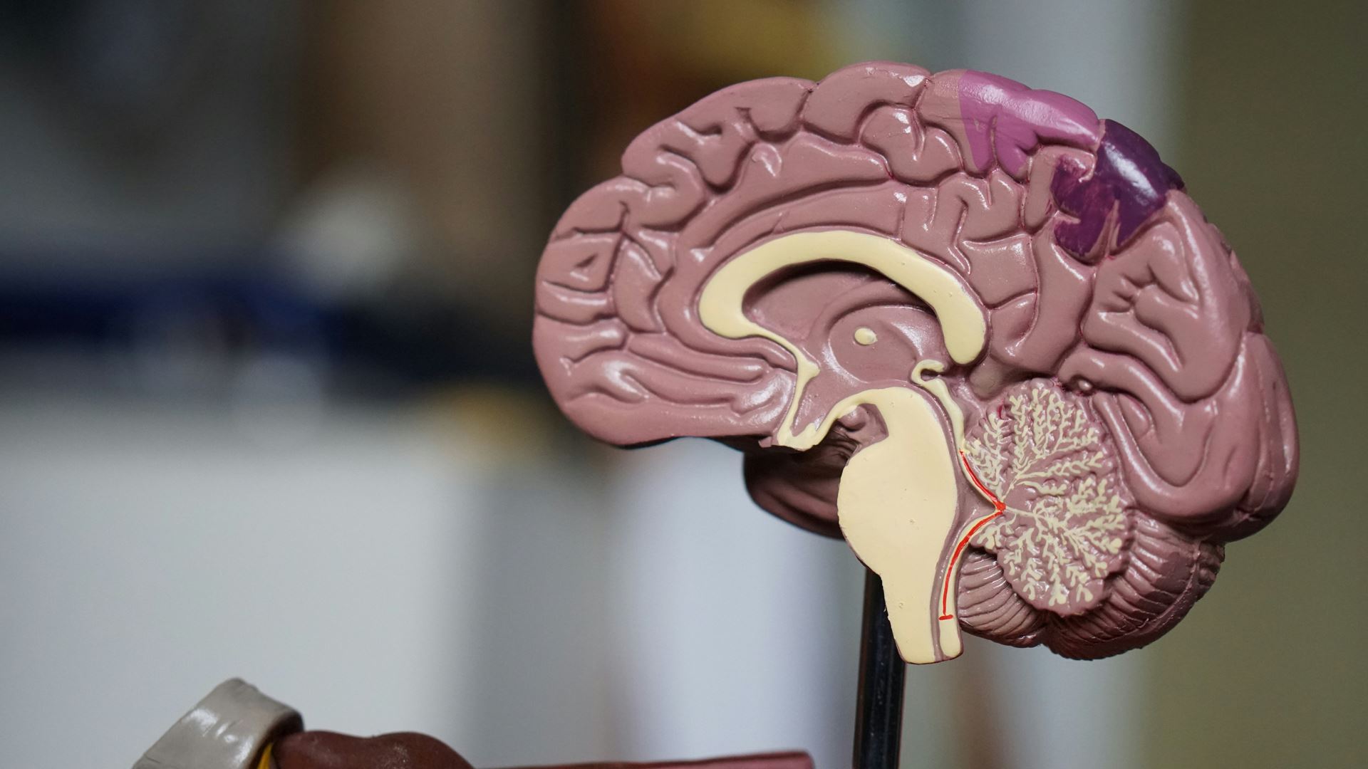 Dementia Review